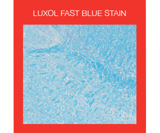 Luxol Fast Blue