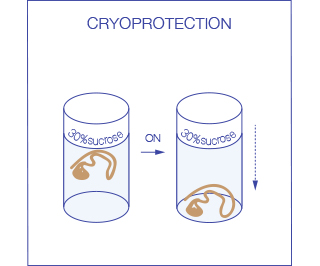 cryoprotection