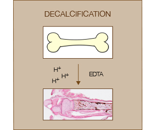 decalcification